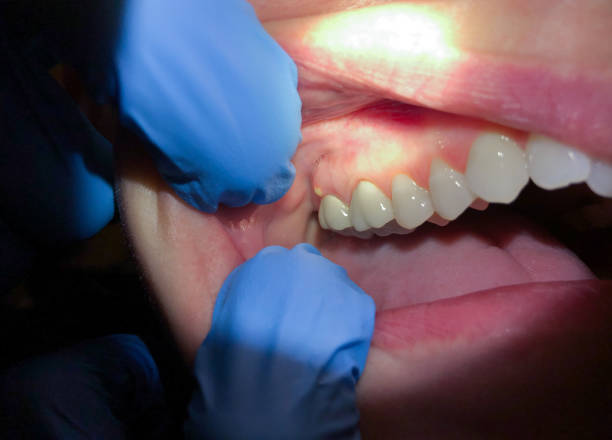 Best Emergency Dentist Near Me  in Seven Corners, VA